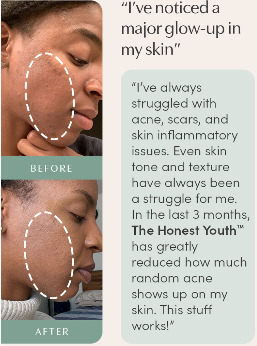 The Honest Youth™, an anti-aging ingestible tincture